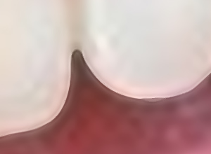 Immagine ingrandita con l’aiuto del programma
