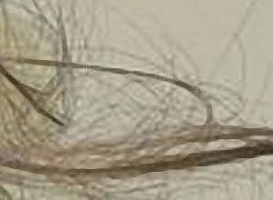 Ridurre "Microlinea"